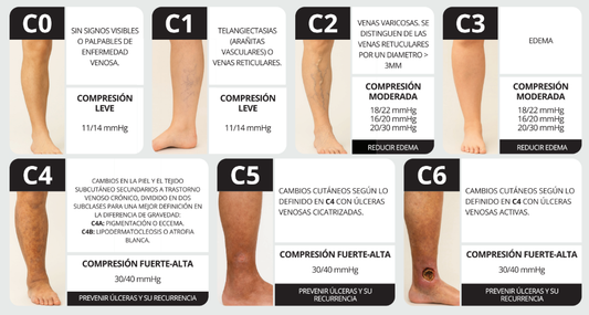 Medias de compresión según tu rutina y signos clínicos